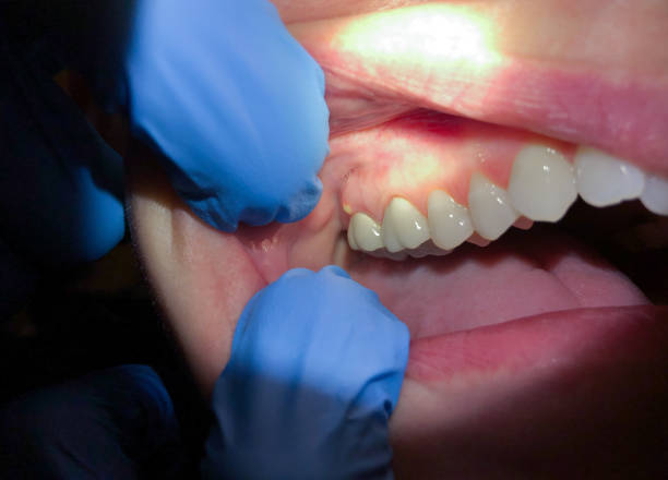 Best Emergency Dentist for Special Needs Patients in Fisher, IL